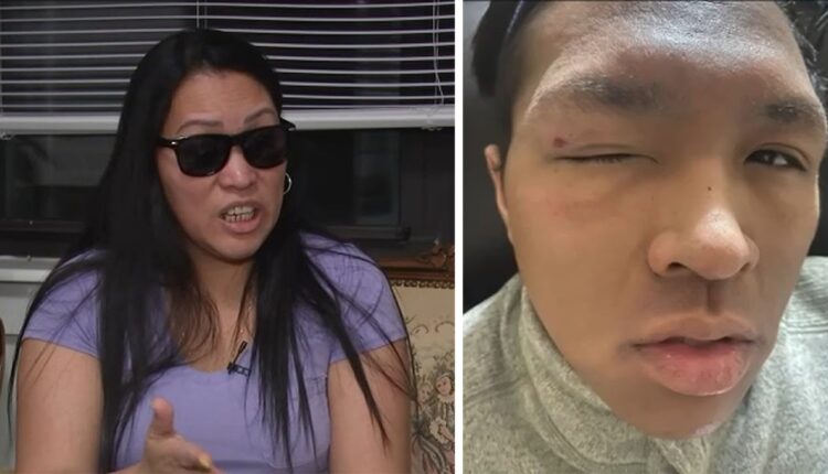 Victim speaks out after hate-filled attack in Queens