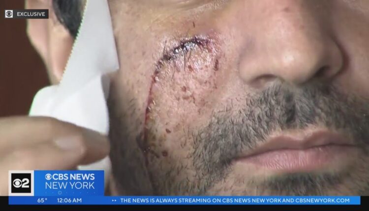 Exclusive: Manhattan gas station worker says he was slashed in face