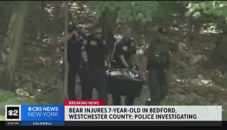 Child hurt in bear encounter in Bedford, N.Y.