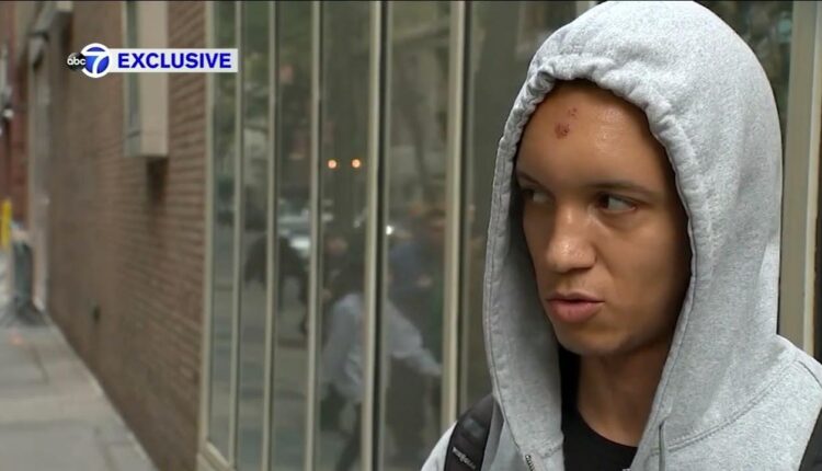 Exclusive: Man speaks out after head split open with wooden plank in subway attack