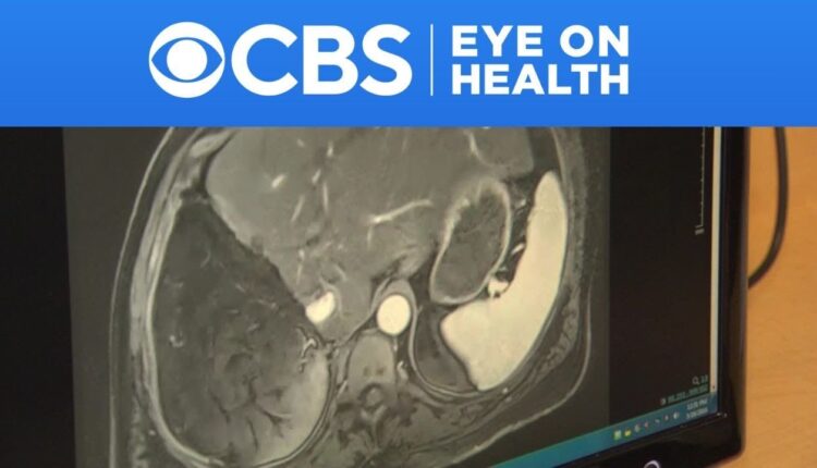 Eye On Health: Jan. 19, 2024