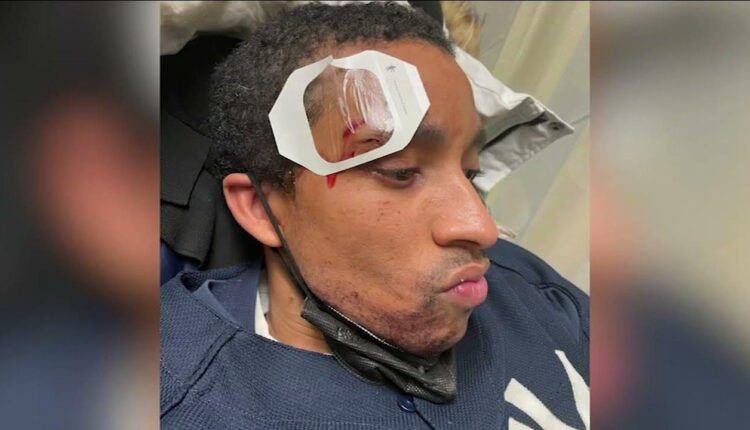 Man with autism punched in the face on Queens subway