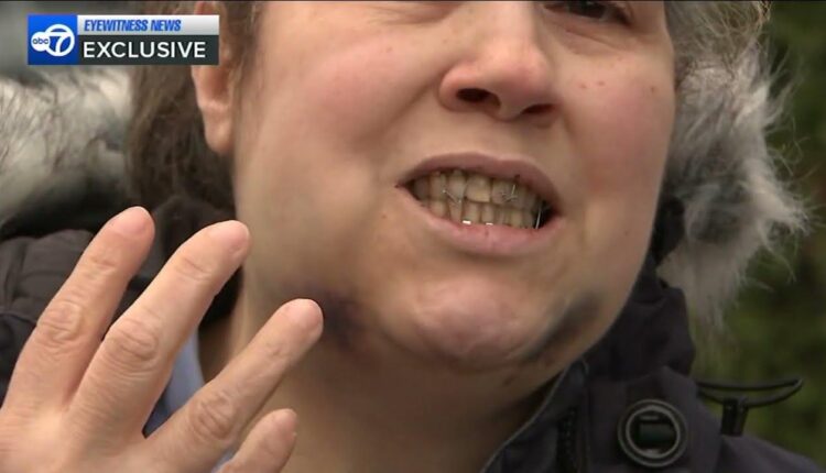 Exclusive: Woman shares terrifying ordeal after random attack
